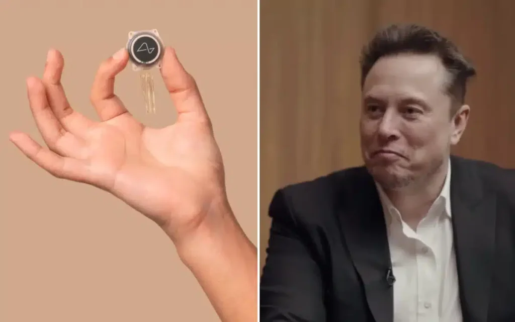 Blindsight- el chip de Elon Musk que podría devolver la vista